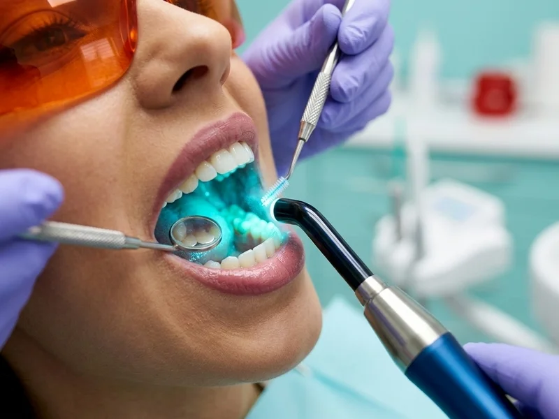 Delicate Tooth Restoration Technique